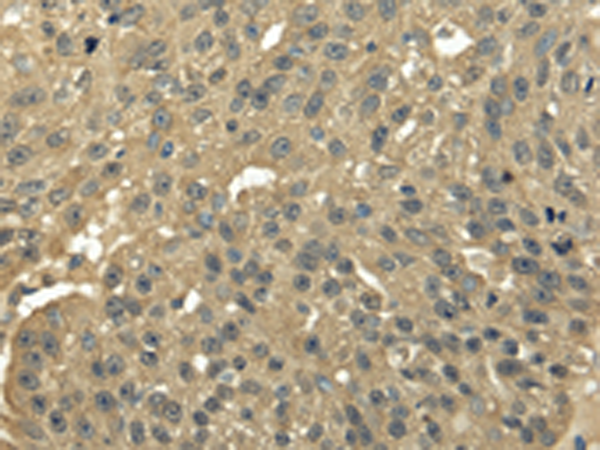 Rabbit Polyclonal Antibody to TFDP2