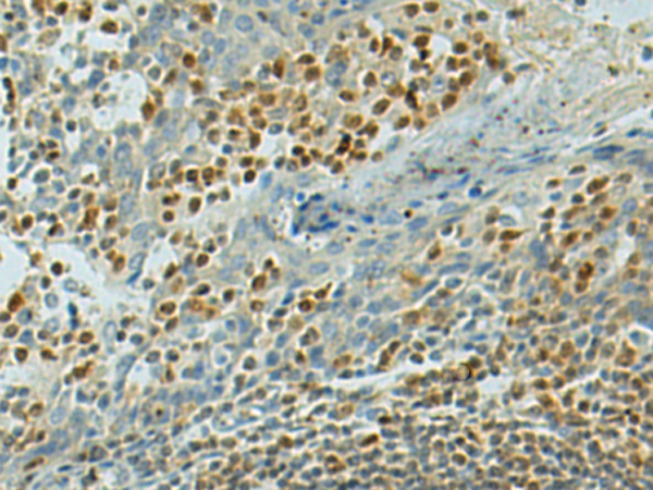 Rabbit Polyclonal Antibody to TFEB