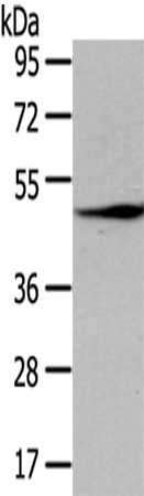 Rabbit Polyclonal Antibody to LEFTY2