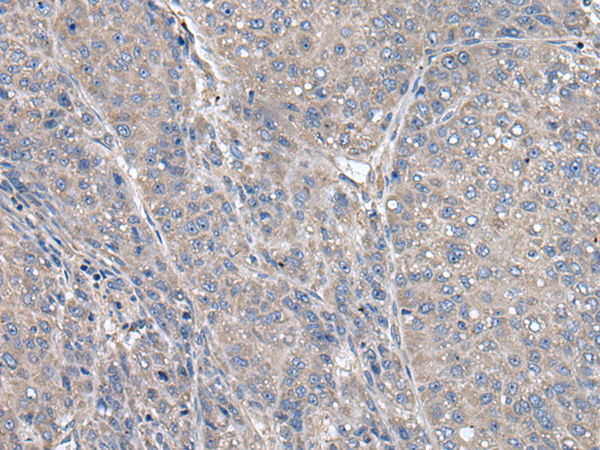 Rabbit Polyclonal Antibody to THAP10