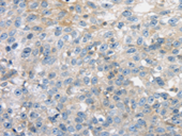 Rabbit Polyclonal Antibody to THAP2