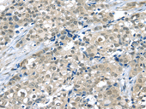 Rabbit Polyclonal Antibody to THAP4