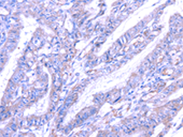 Rabbit Polyclonal Antibody to THAP6