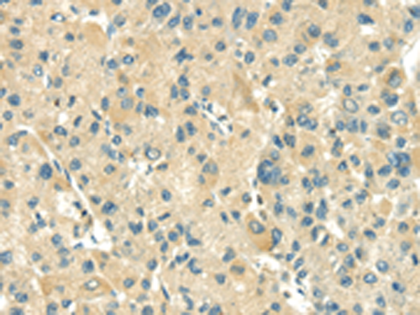 Rabbit Polyclonal Antibody to TXN2