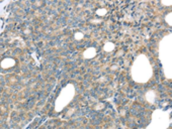 Rabbit Polyclonal Antibody to THSD1