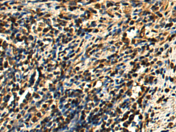Rabbit Polyclonal Antibody to PTMA