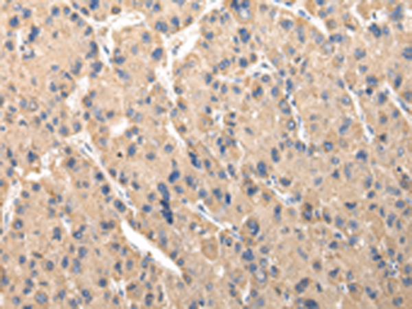 Rabbit Polyclonal Antibody to SERPINA7