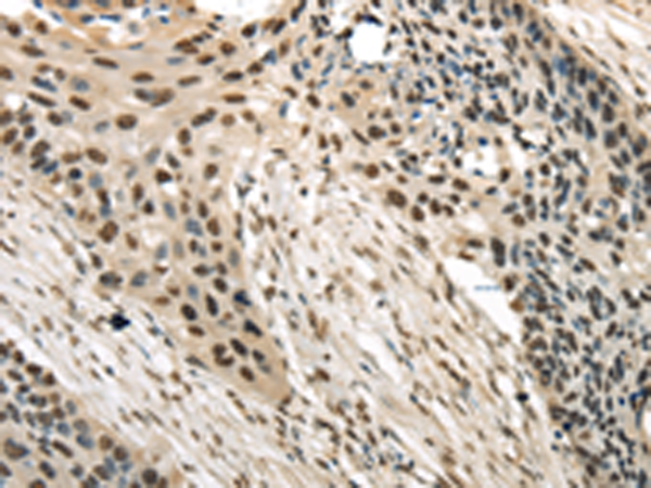 Rabbit Polyclonal Antibody to TRIM11