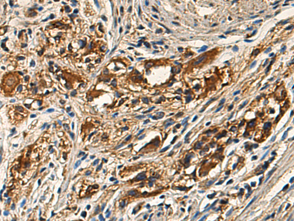 Rabbit Polyclonal Antibody to TRIM26