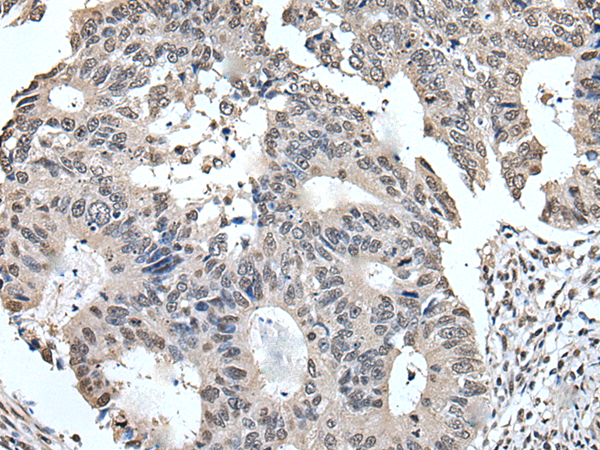 Rabbit Polyclonal Antibody to TRIM23