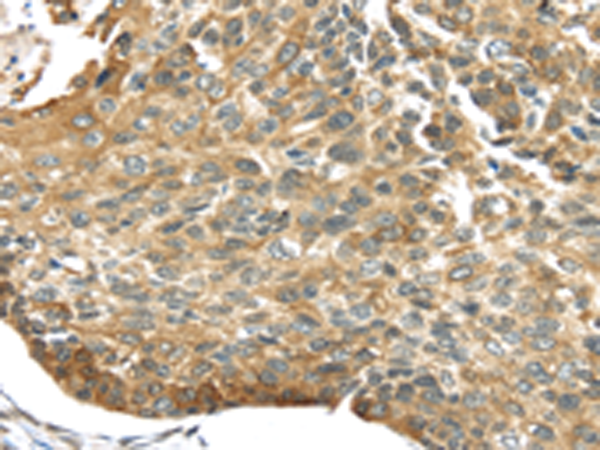 Rabbit Polyclonal Antibody to TRIM16