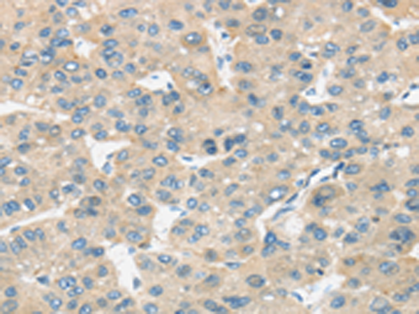 Rabbit Polyclonal Antibody to TIRAP