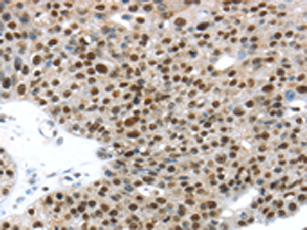 Rabbit Polyclonal Antibody to TKTL1
