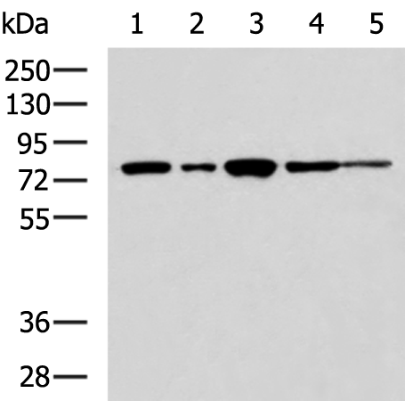 Rabbit Polyclonal Antibody to TLK2
