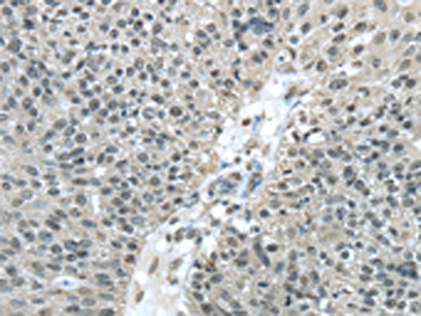 Rabbit Polyclonal Antibody to FUS