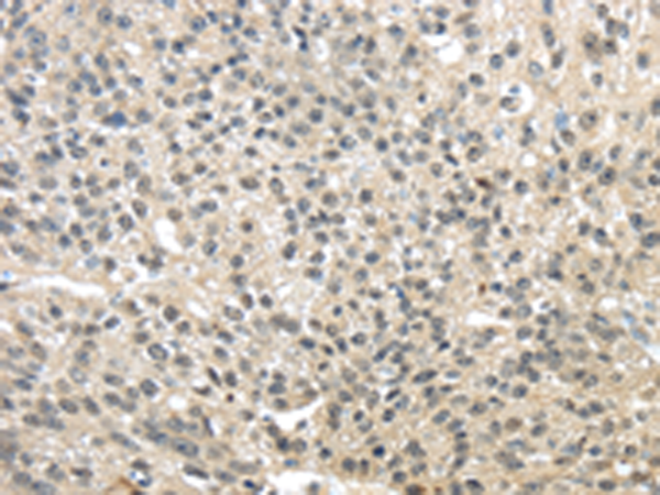 Rabbit Polyclonal Antibody to TMED3