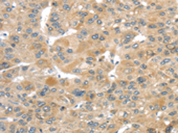 Rabbit Polyclonal Antibody to TMEM161A