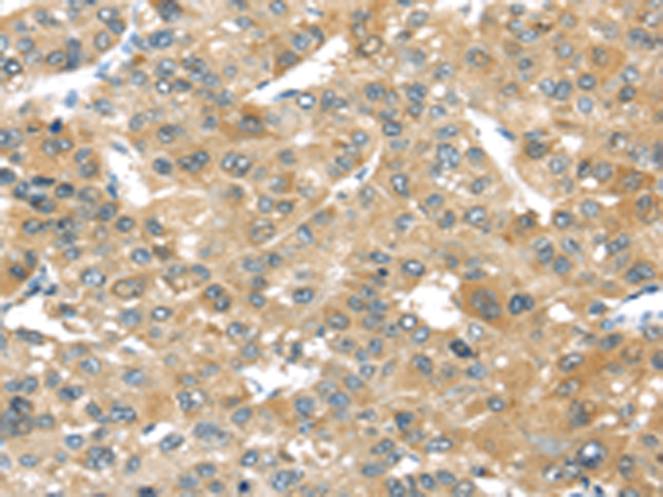 Rabbit Polyclonal Antibody to TMPRSS4