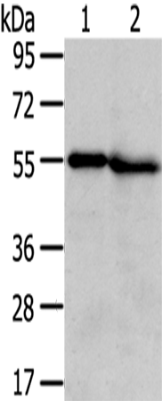 Rabbit Polyclonal Antibody to TMPRSS5