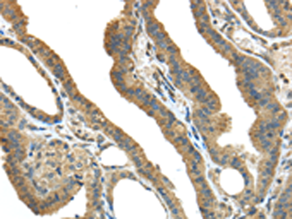 Rabbit Polyclonal Antibody to TMPRSS13