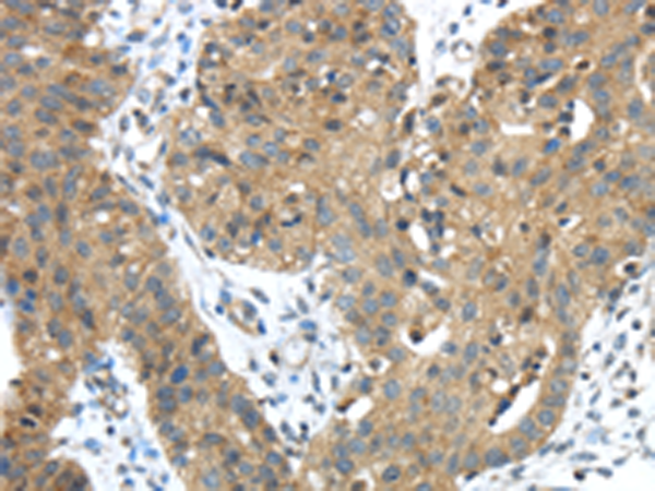 Rabbit Polyclonal Antibody to TMPRSS11E