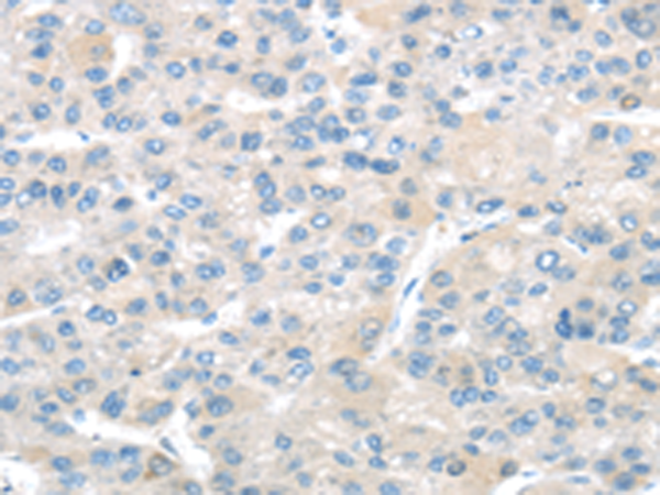 Rabbit Polyclonal Antibody to TMPRSS11A
