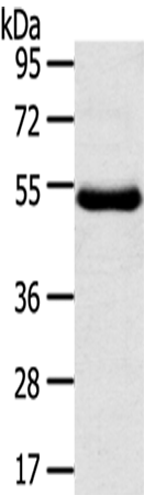 Rabbit Polyclonal Antibody to TMPRSS11D