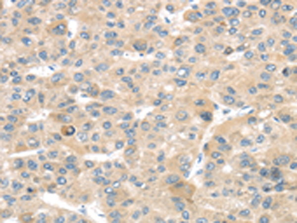 Rabbit Polyclonal Antibody to TMPRSS11B