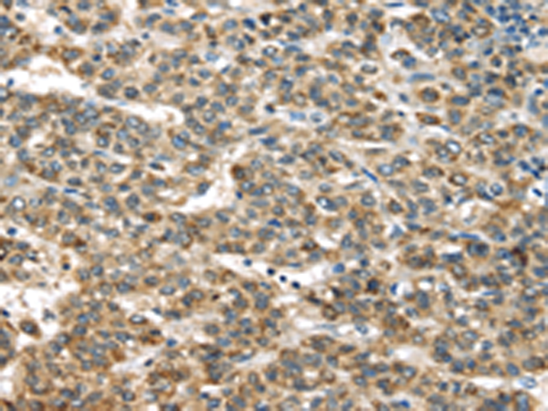 Rabbit Polyclonal Antibody to TNFAIP2