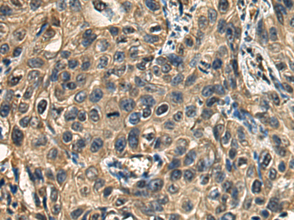 Rabbit Polyclonal Antibody to TNFAIP3