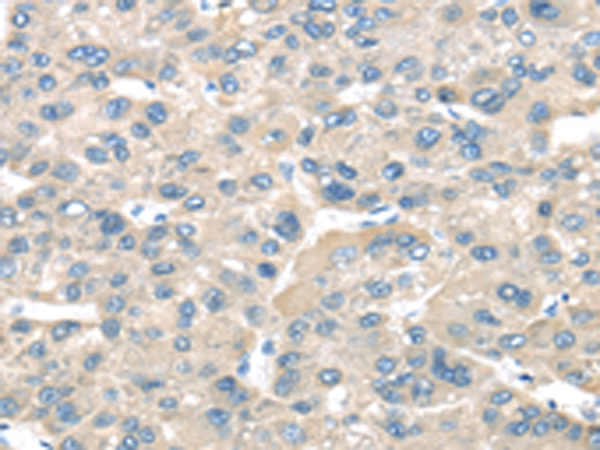 Rabbit Polyclonal Antibody to TNFAIP8