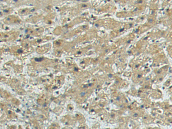 Rabbit Polyclonal Antibody to TMEFF1