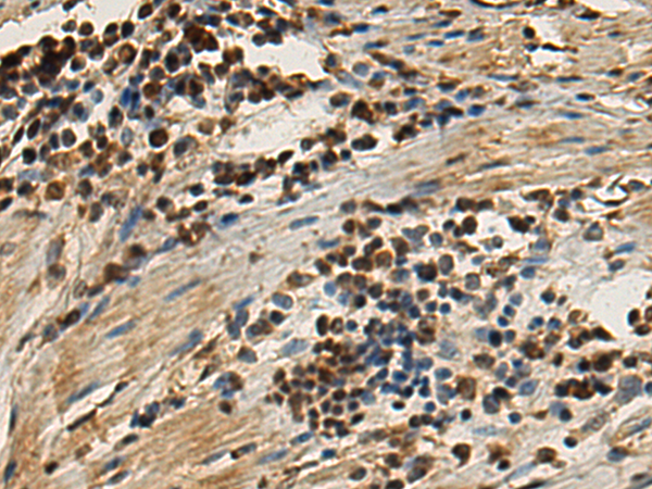Rabbit Polyclonal Antibody to TEP1
