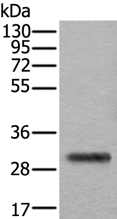 Rabbit Polyclonal Antibody to TPSB2