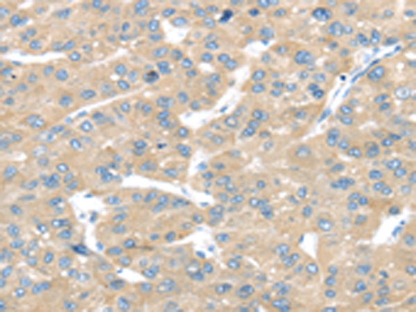 Rabbit Polyclonal Antibody to TRAK1