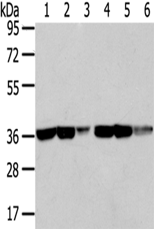 Rabbit Polyclonal Antibody to TALDO1