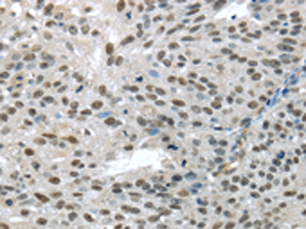 Rabbit Polyclonal Antibody to TKT