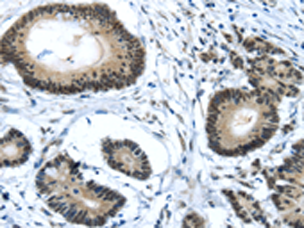 Rabbit Polyclonal Antibody to MED4