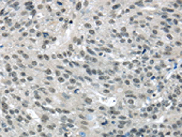 Rabbit Polyclonal Antibody to MED15