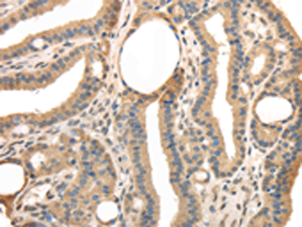 Rabbit Polyclonal Antibody to TRIB3