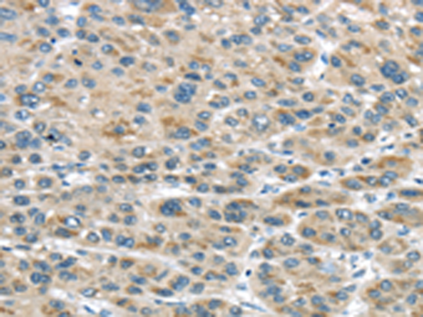 Rabbit Polyclonal Antibody to TRAIP