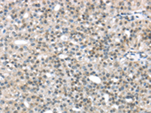 Rabbit Polyclonal Antibody to TRIP6