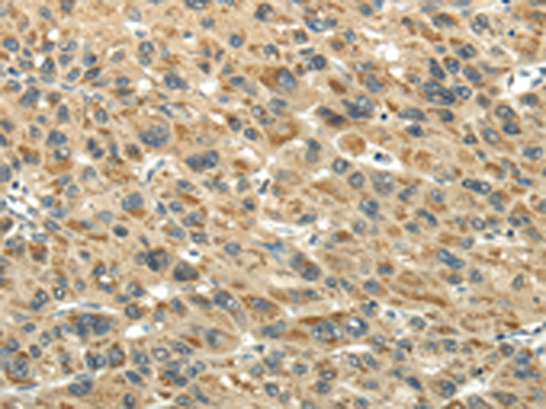Rabbit Polyclonal Antibody to KEAP1