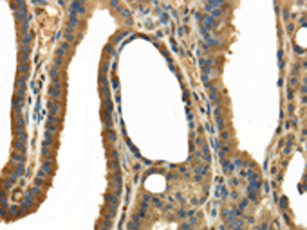 Rabbit Polyclonal Antibody to TRPC4AP