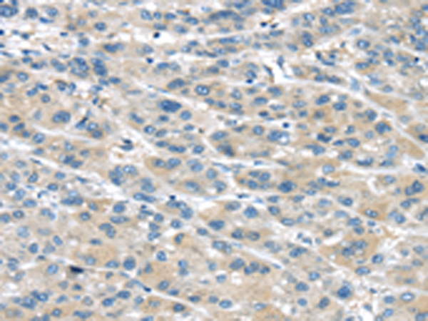 Rabbit Polyclonal Antibody to TRPM2