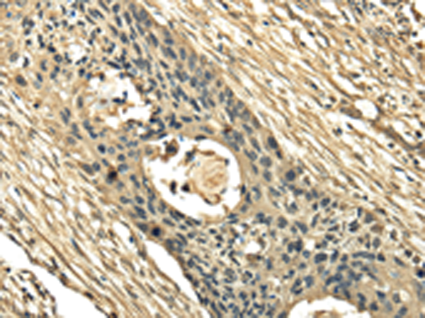 Rabbit Polyclonal Antibody to EIPR1