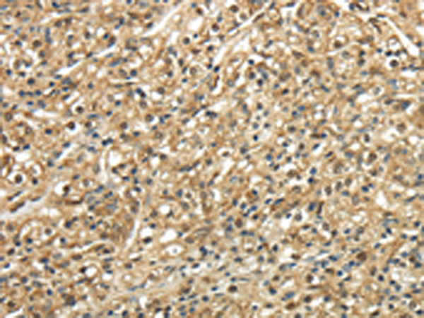 Rabbit Polyclonal Antibody to TSC22D1