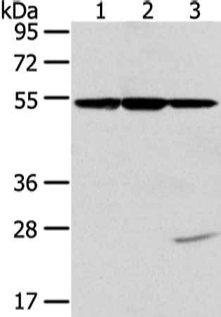 Rabbit Polyclonal Antibody to TUBA1C