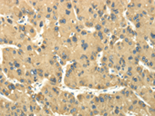 Rabbit Polyclonal Antibody to TULP2