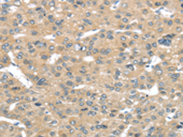 Rabbit Polyclonal Antibody to TUSC2